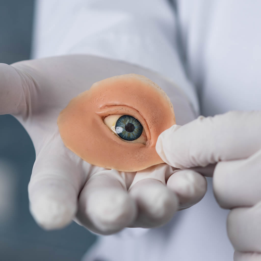 Prótesis oculo palpebral